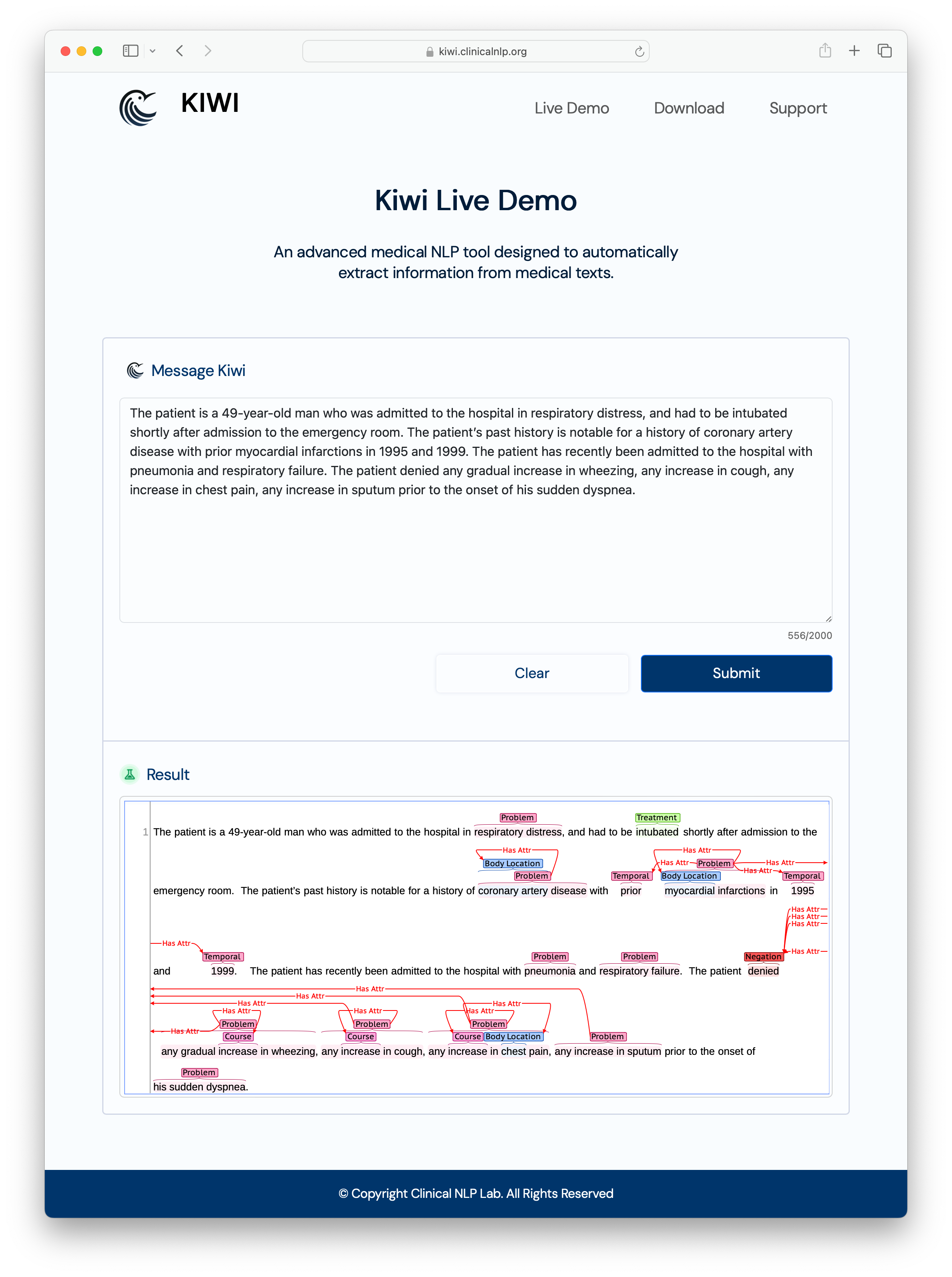 kiwi demo pic